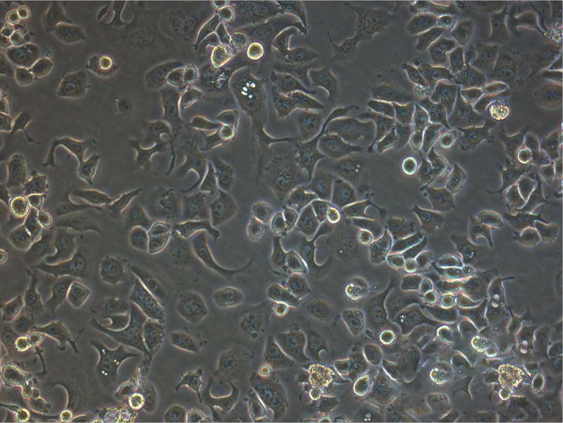 NCI-H2170 Cells|人肺鳞癌克隆细胞