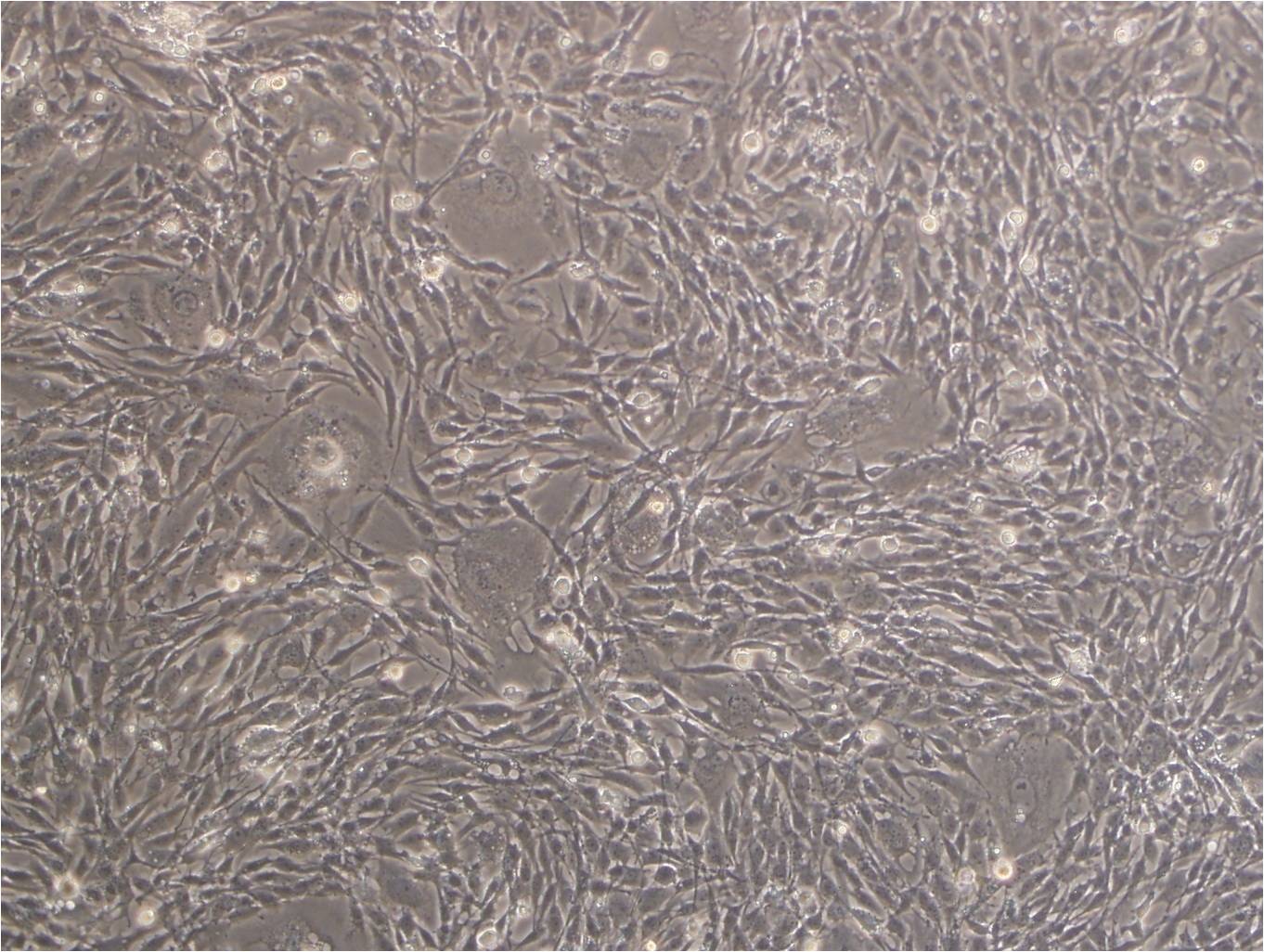 NCI-H1299 Cells|人非小细胞肺癌克隆细胞