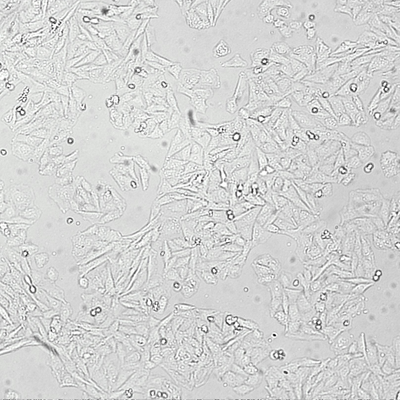 Saos-2人成骨肉瘤细胞