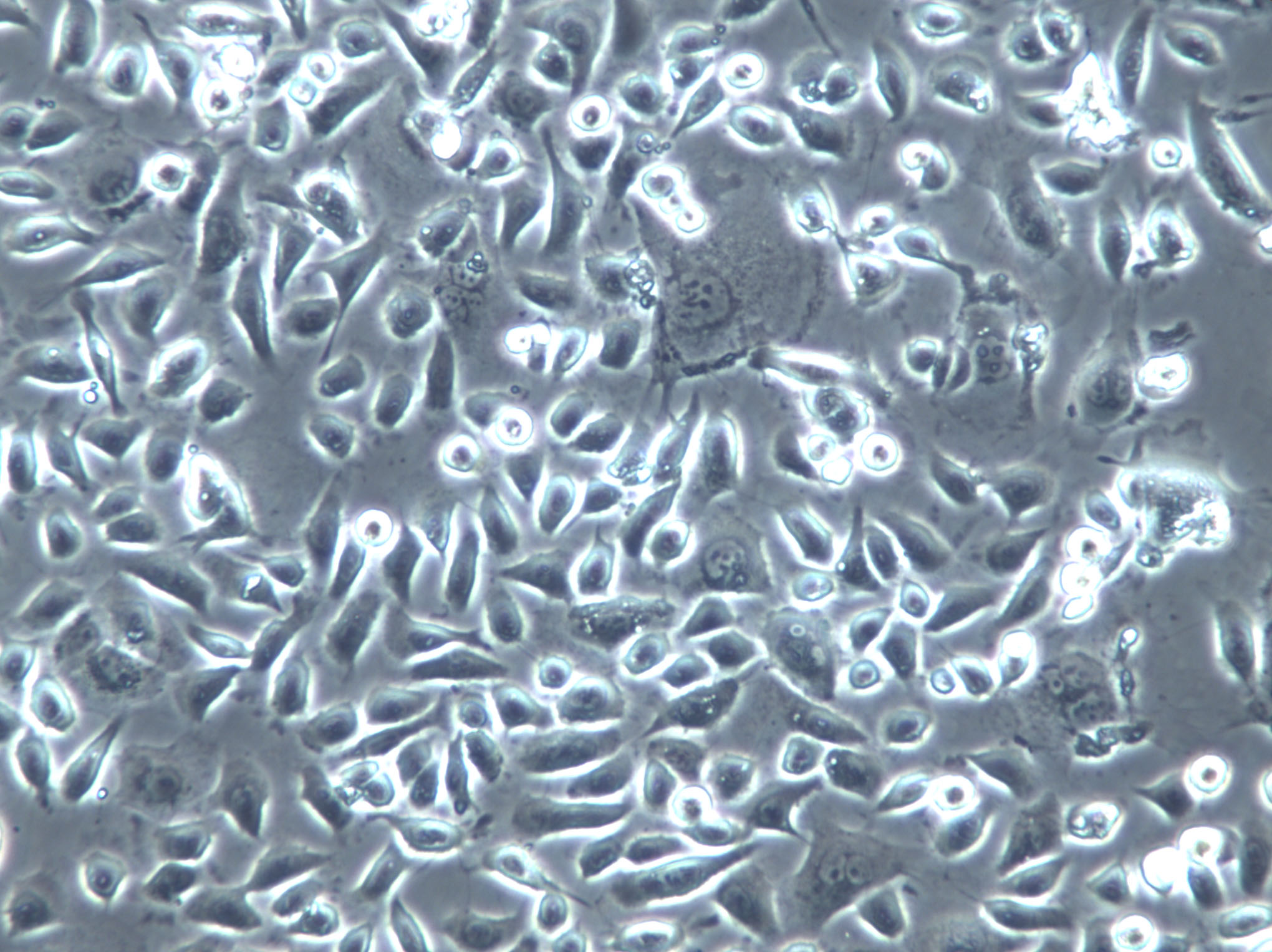 UM-RC-2 Cells(赠送Str鉴定报告)|人肾透明细胞癌细胞