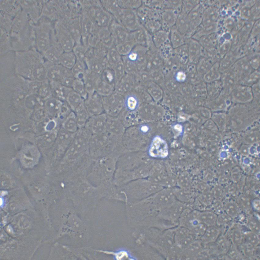 HT115 Cells(赠送Str鉴定报告)|人结肠癌细胞