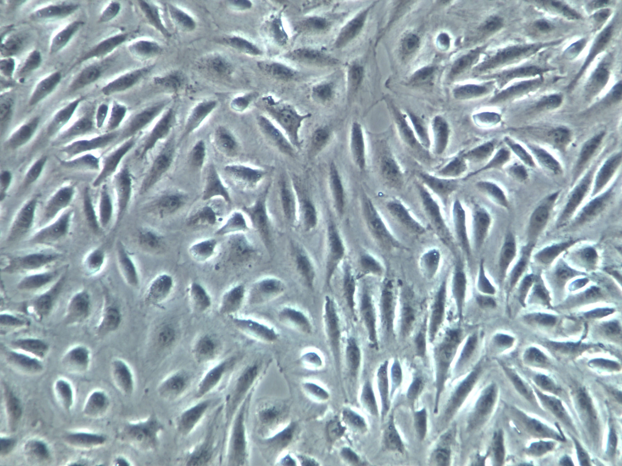 RKO-E6 Cells|人结肠癌转基因克隆细胞