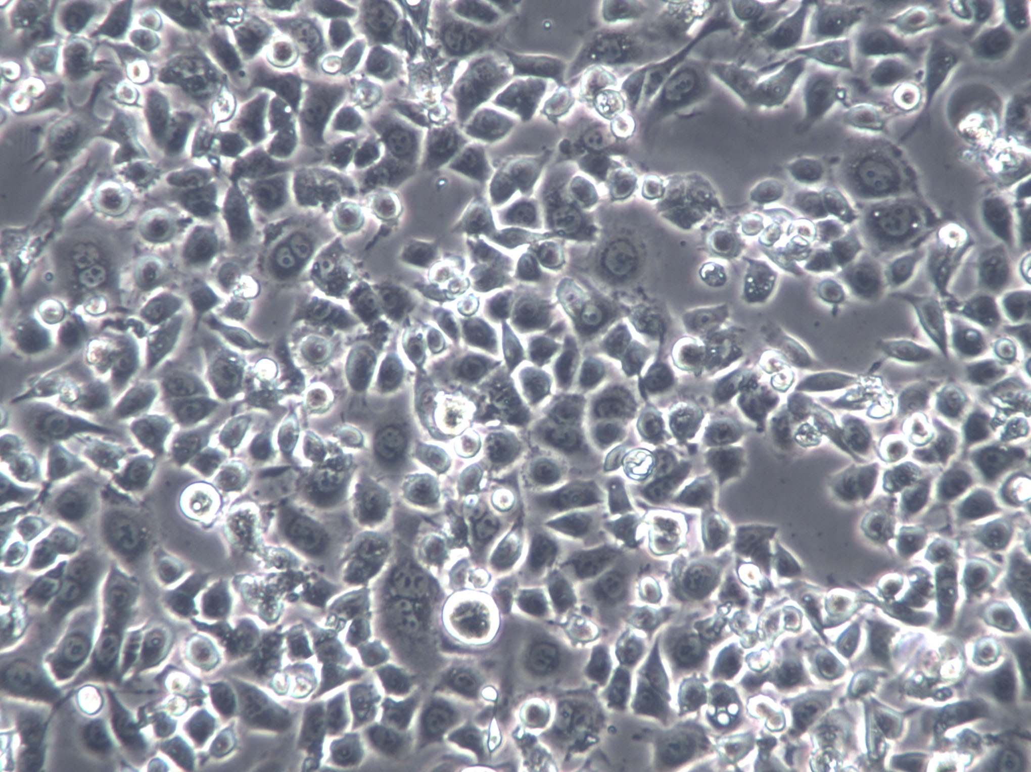 SW1990 Cells|人胰腺癌克隆细胞