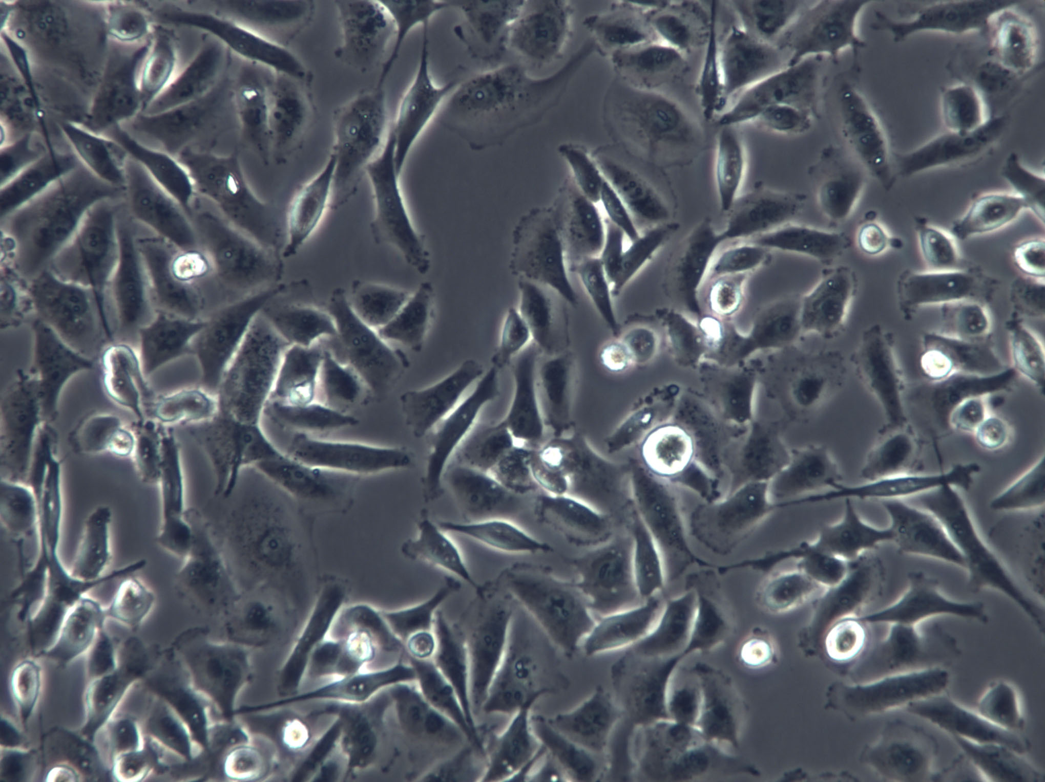 CHG-5 Cells(赠送Str鉴定报告)|人恶性胶质瘤细胞