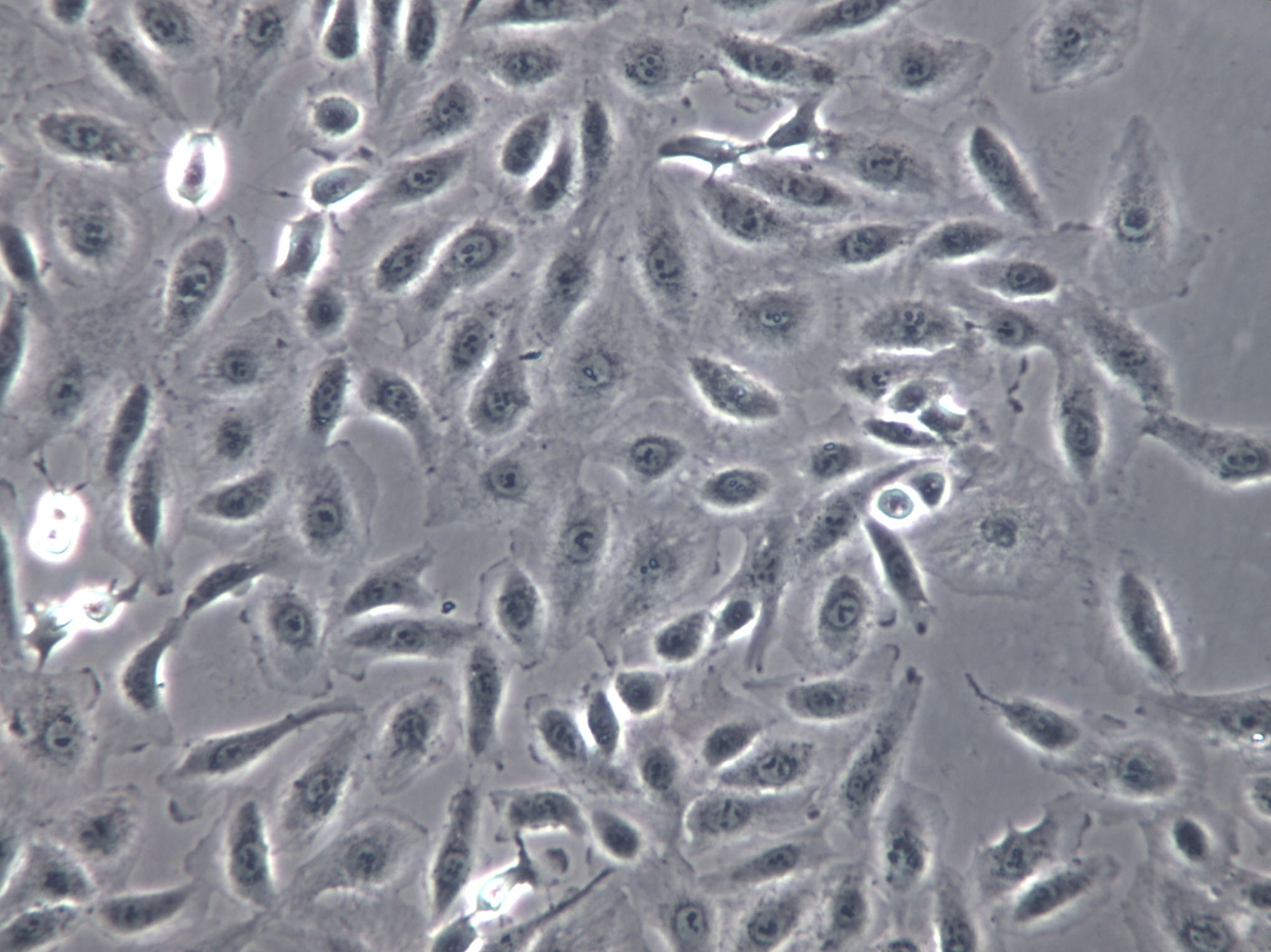 TCam-2 Cells|人睾丸精原细胞瘤克隆细胞