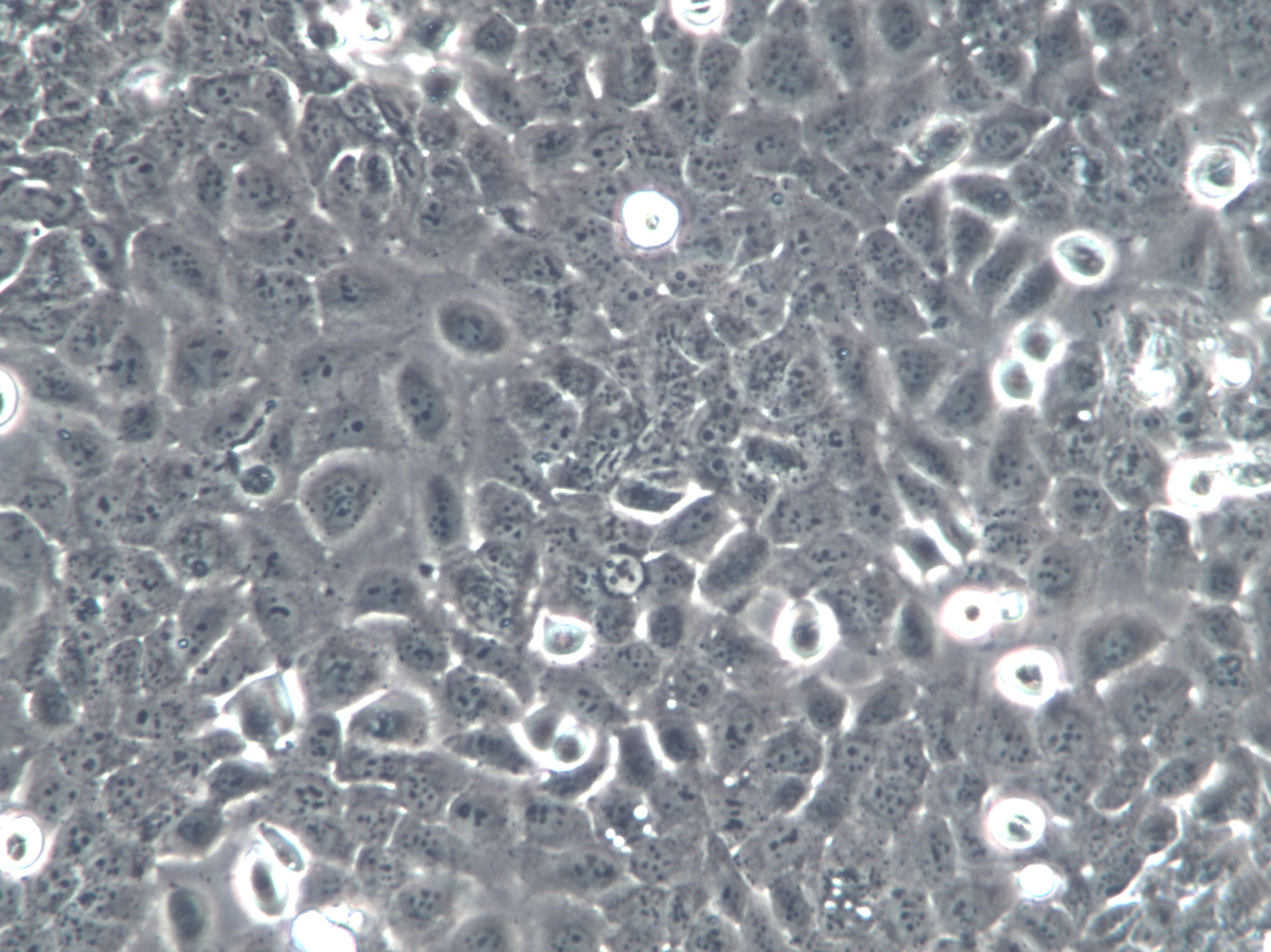 IR983F Cells(赠送Str鉴定报告)|大鼠骨髓瘤细胞