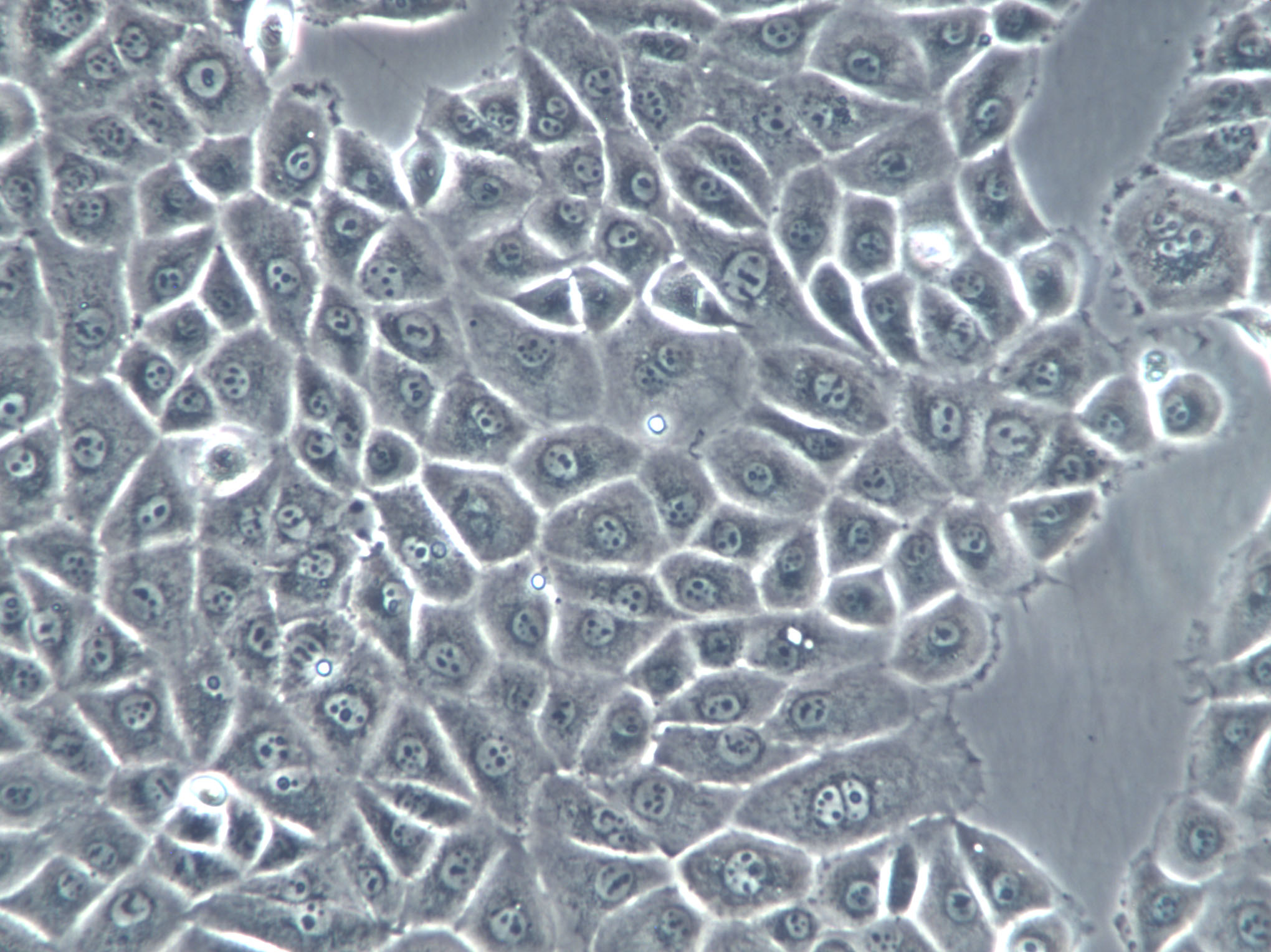 KTA7 Cells(赠送Str鉴定报告)|人肺腺癌细胞