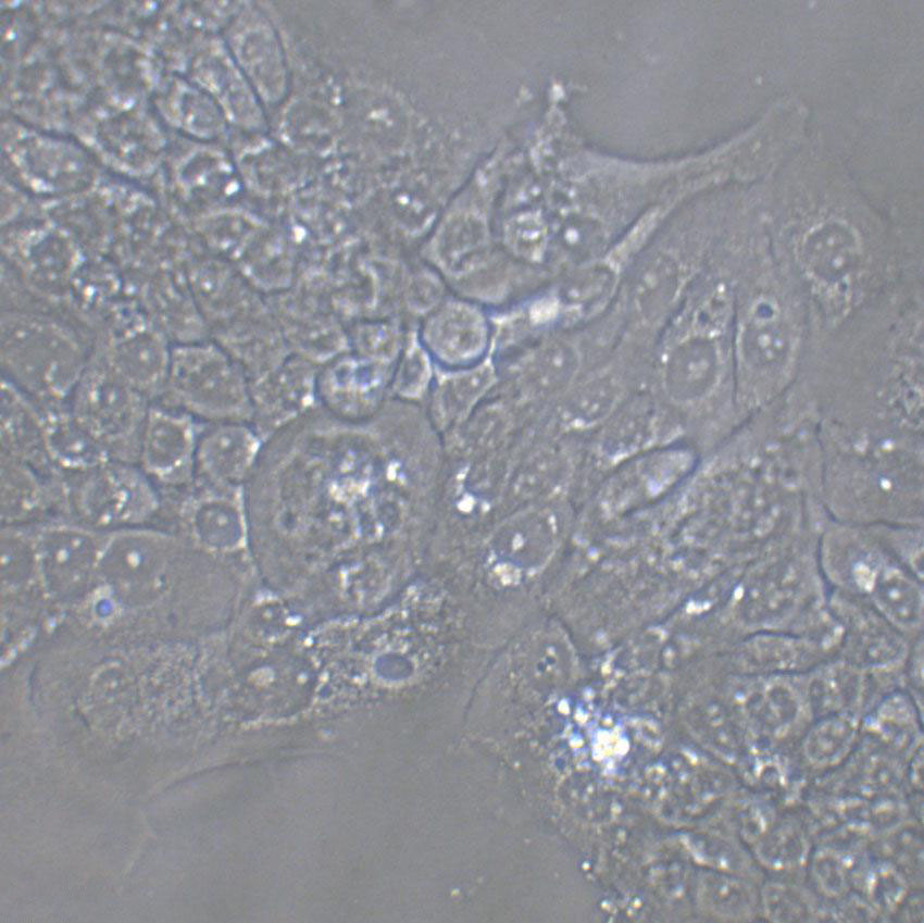 B-3 Cells(赠送Str鉴定报告)|人晶状体上皮细胞