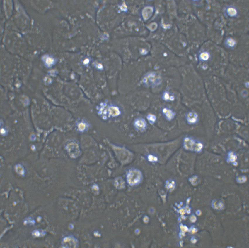 SSP-25 Cells(赠送Str鉴定报告)|人肝胆管癌细胞