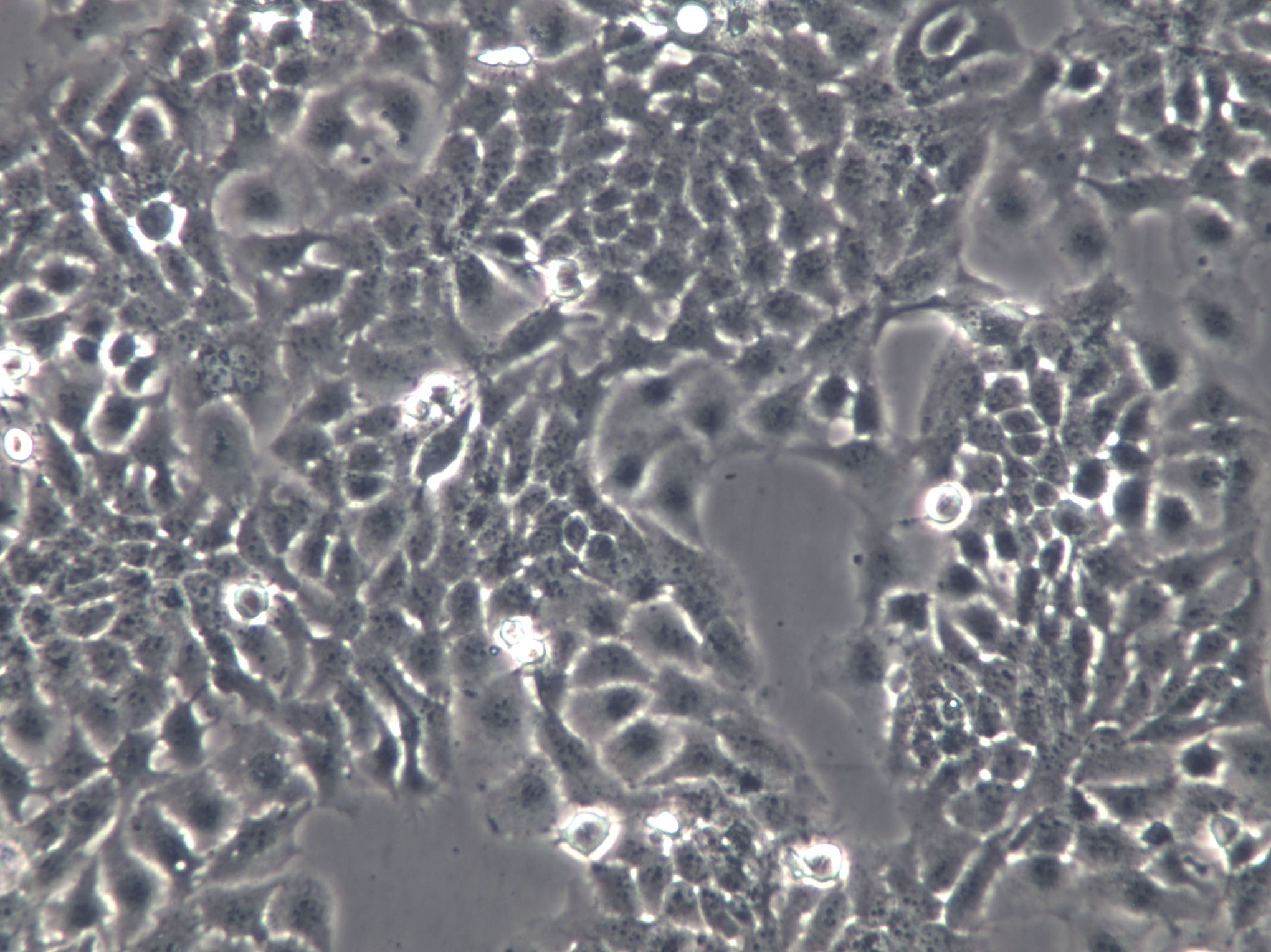 Ect1/E6E7 Cells|人宫颈永生化鳞状克隆细胞