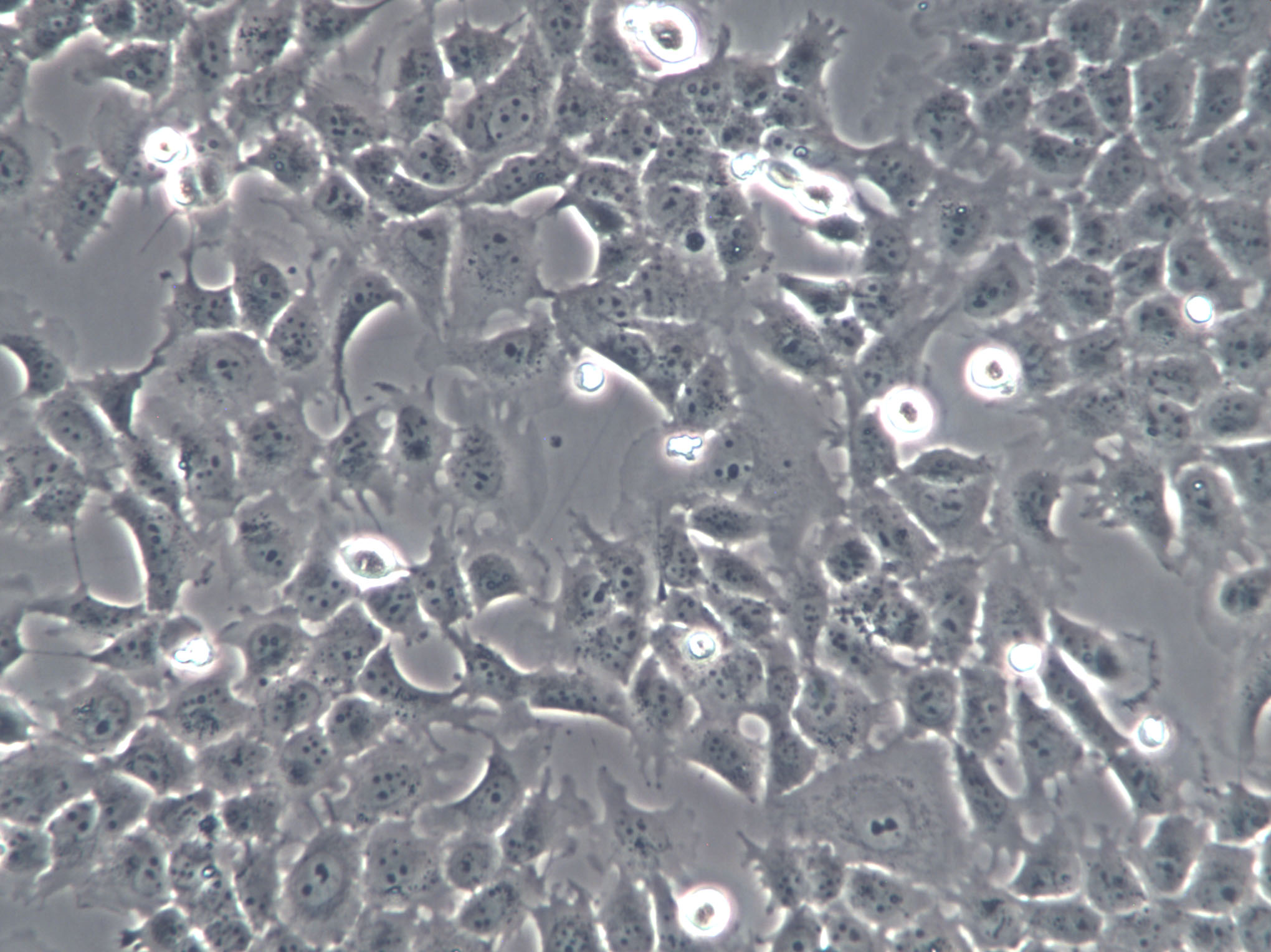 Hca-F Cells|小鼠肝癌克隆细胞