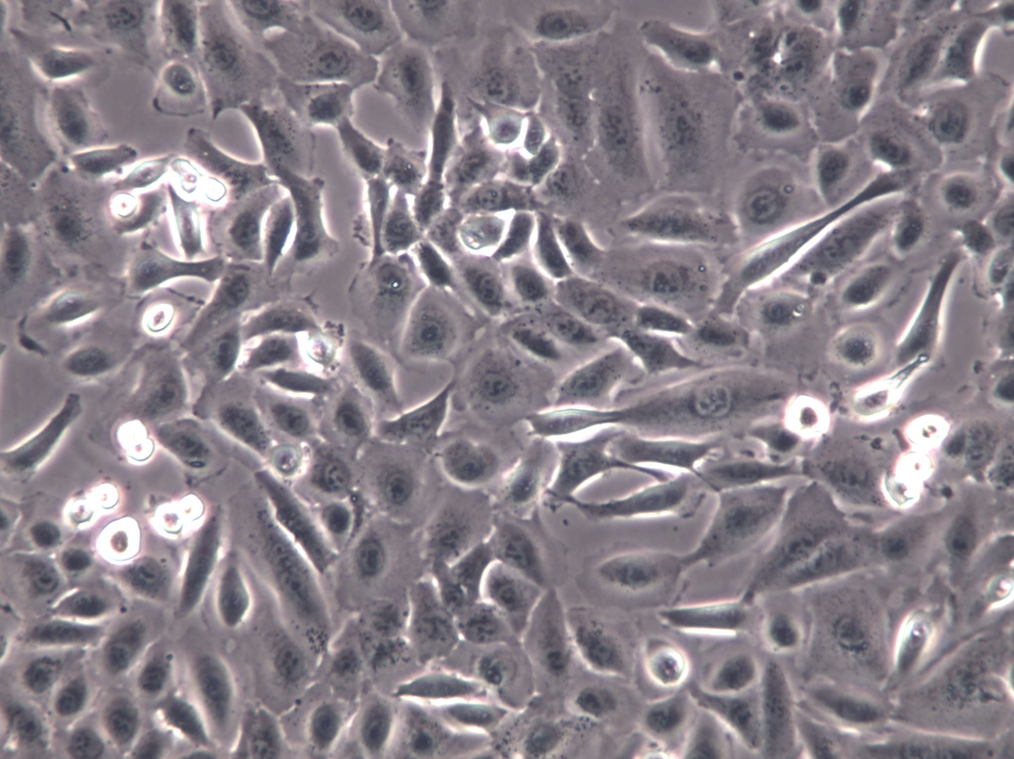 HCC1588 Cells|人肺鳞癌克隆细胞