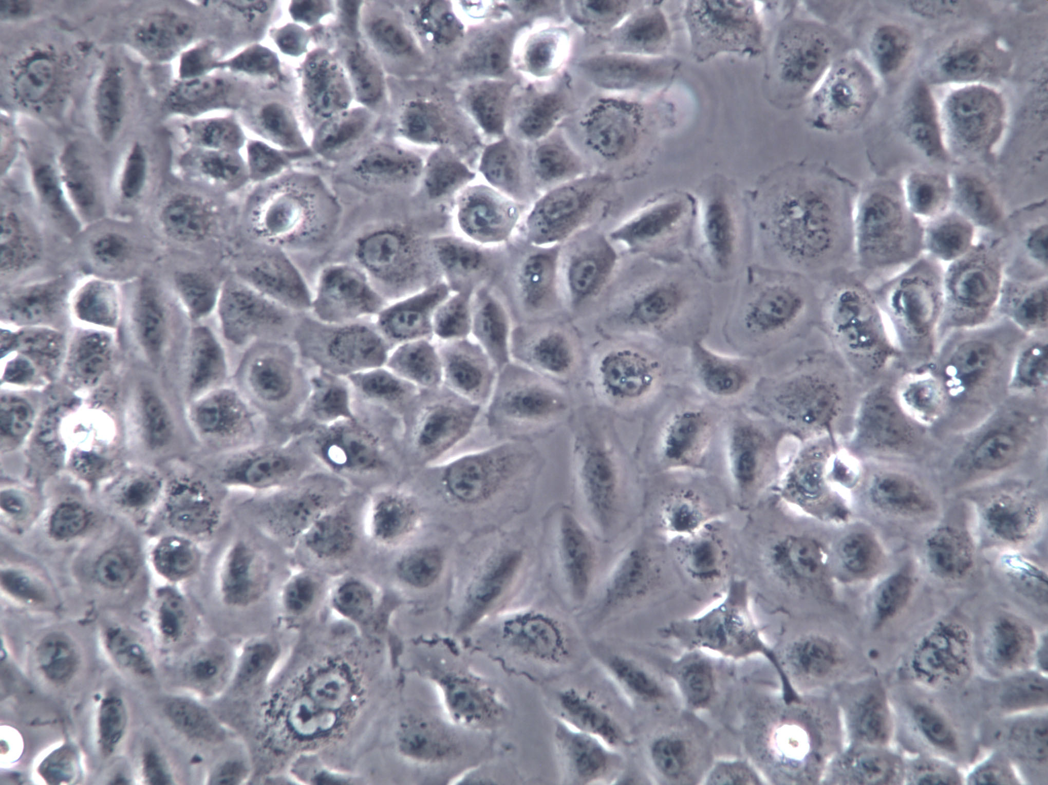 PC-3M Cells(赠送Str鉴定报告)|人前列腺癌细胞