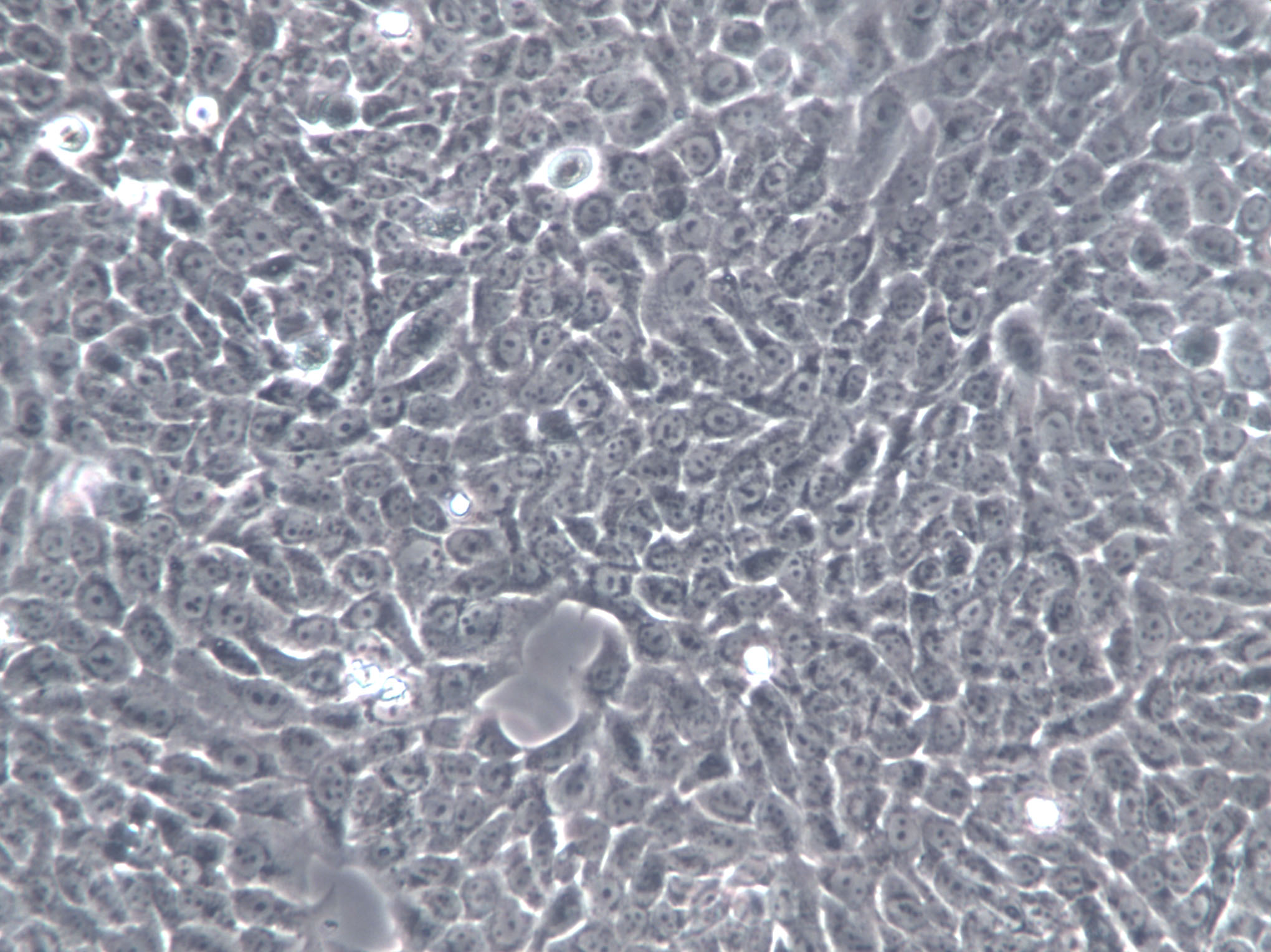 HCC2108 Cells|人肺癌腺癌克隆细胞