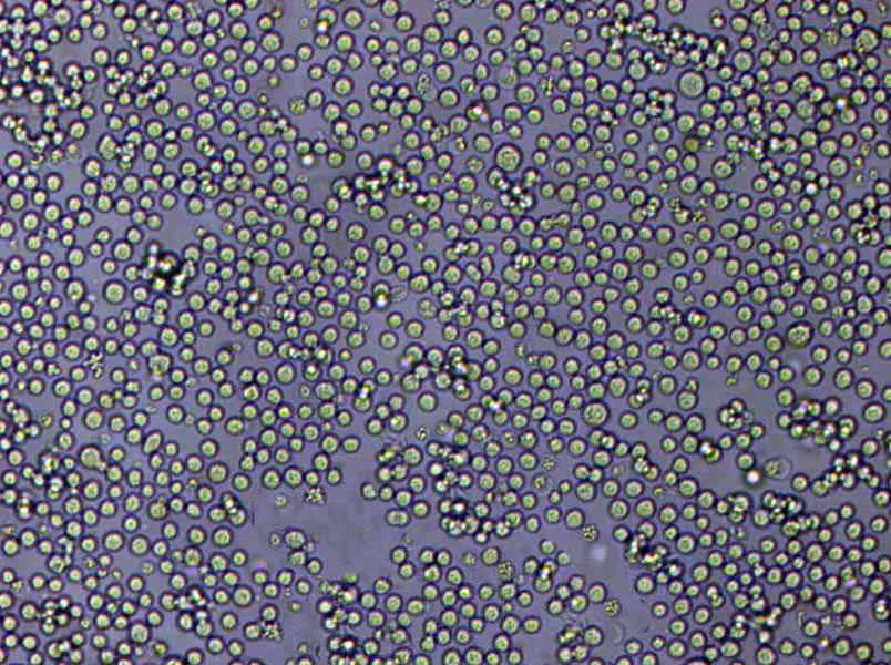 HFLS-RA Cells|类风湿关节炎成纤维样滑膜克隆细胞