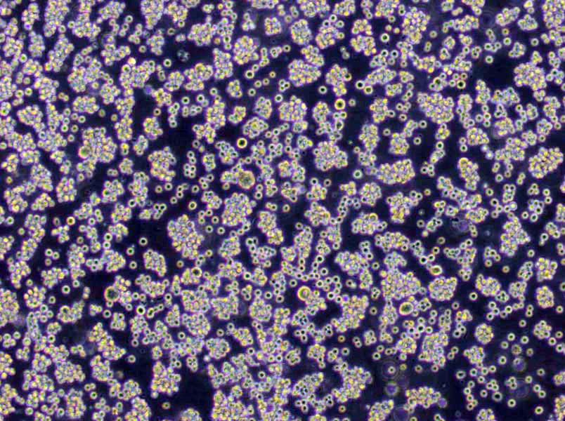 NRK-49F Cells|大鼠正常肾成纤维克隆细胞