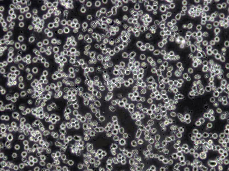 CCD-19Lu Cells|人肺成纤维克隆细胞