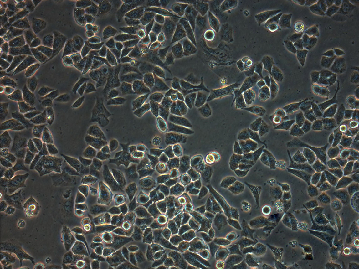 IMR-32 Cells|人神经母细胞瘤可传代细胞系