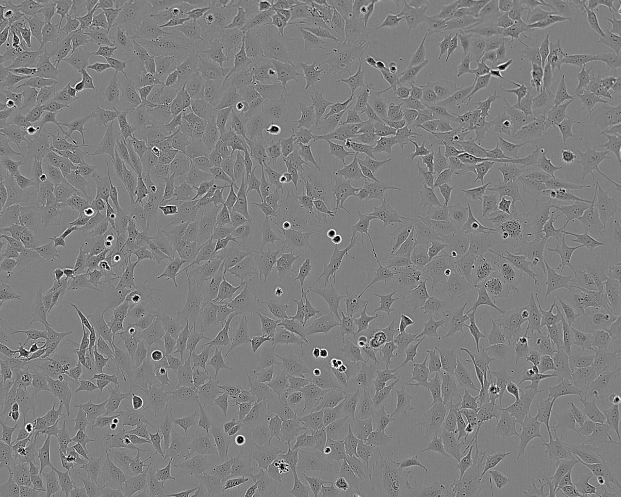 SK-N-SH Cells|人神经母细胞瘤可传代细胞系