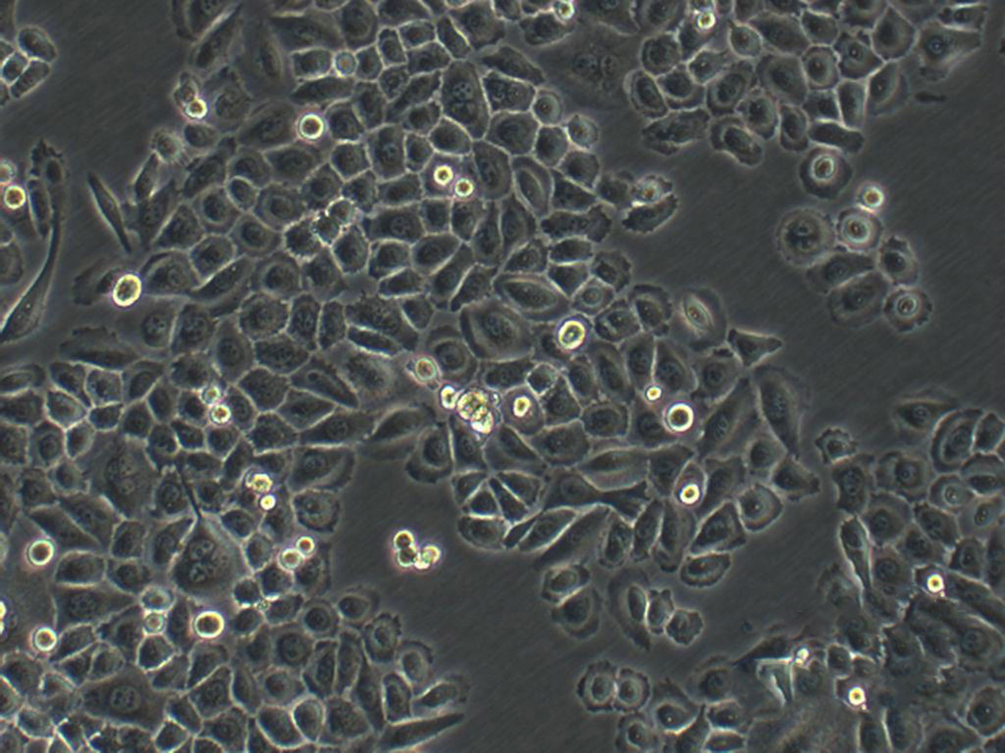 NCI-H1703 Cells|人肺腺鳞癌可传代细胞系