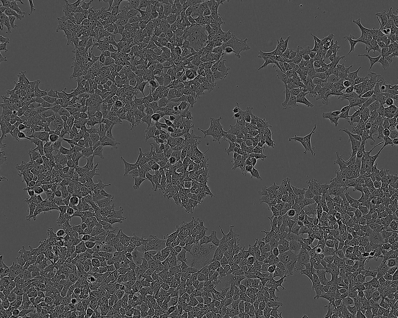 NCI-H1299 Cells(赠送Str鉴定报告)|人非小细胞肺癌细胞