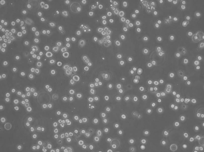 6T-CEM Cells|人T细胞白血病可传代细胞系