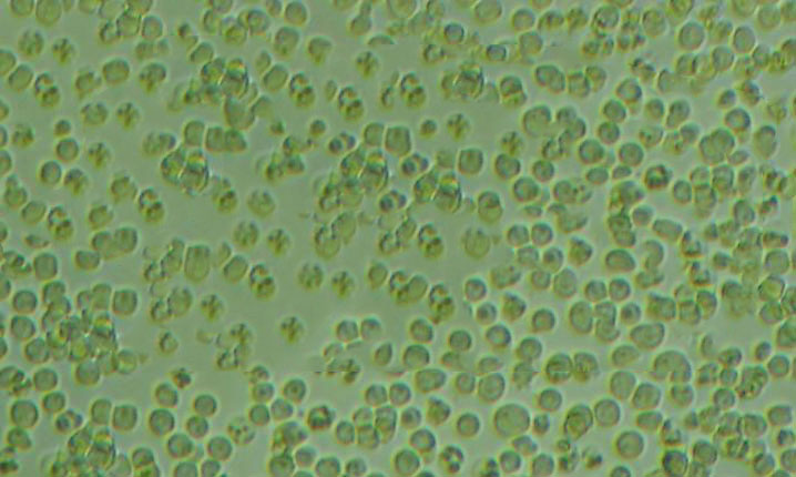 HSC-2 Cells(赠送Str鉴定报告)|皮肤鳞状细胞癌细胞