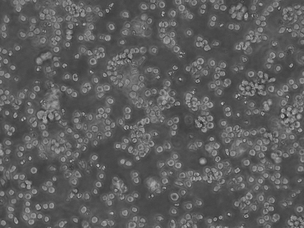 OCI-Ly8 Cells|人弥漫大B淋巴瘤可传代细胞系