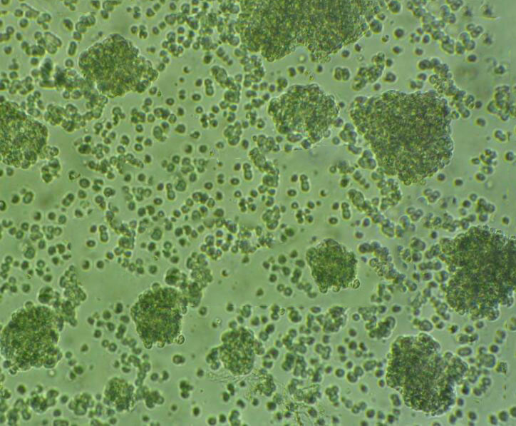 SU-DHL-16 Cells|人B淋巴瘤可传代细胞系