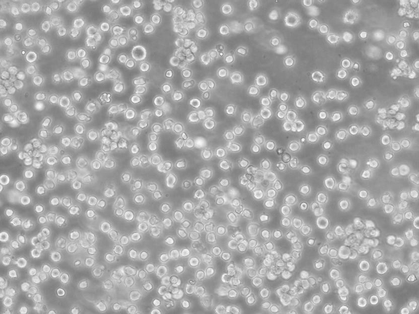 MT-4 Cell急性淋巴母细胞白血病传代培养