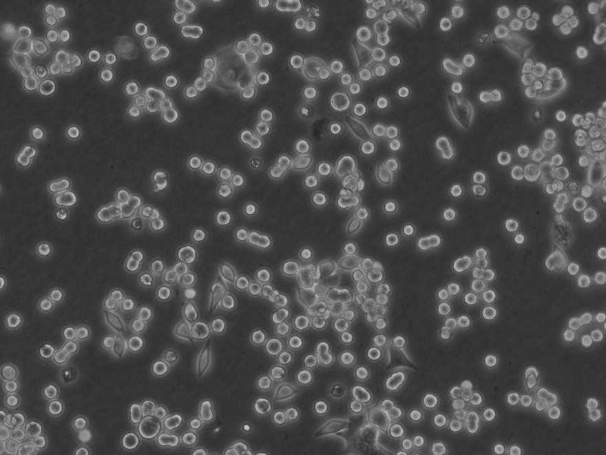 T24 Cell膀胱移行细胞癌传代培养