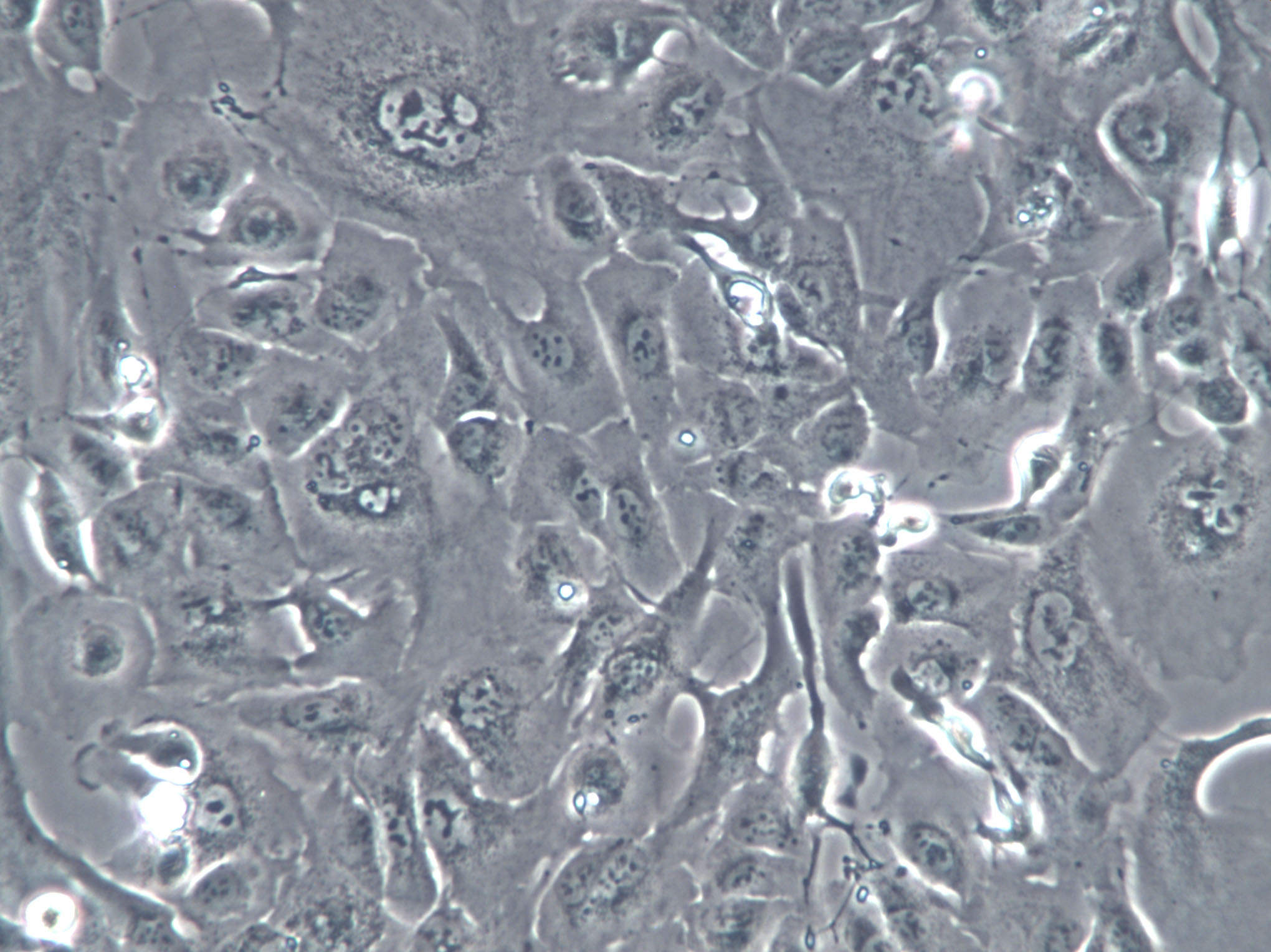 NCI-H2009人肺腺癌复苏细胞(附STR鉴定报告)