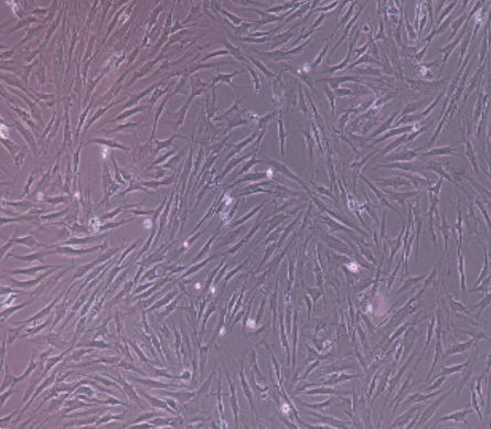 癌UM-UC-3人膀胱移行细胞