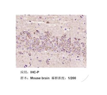 VCAP(ATCC)人前列腺癌细胞