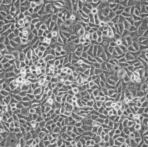 Calu-6人退行性癌细胞