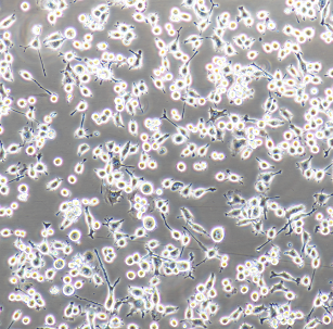 UACC-812人乳腺导管癌细胞