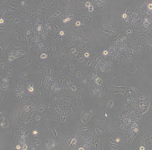 HUVEC(sciencell)人脐静脉内皮细胞