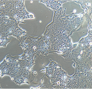 HCC1599人乳腺导管癌细胞