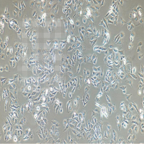 SW837人结直肠腺癌细胞