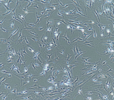 HCC-2935人肺腺癌细胞