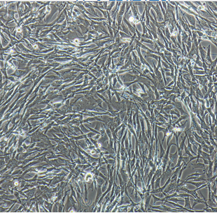 HDLM-2人霍奇金淋巴瘤细胞