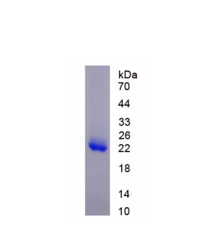 组蛋白脱乙酰基酶6(HDAC6)重组蛋白