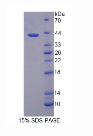 3-羟基丁酸脱氢酶1(BDH1)重组蛋白