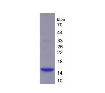 半胱氨酸蛋白酶抑制剂4(CST4)重组蛋白