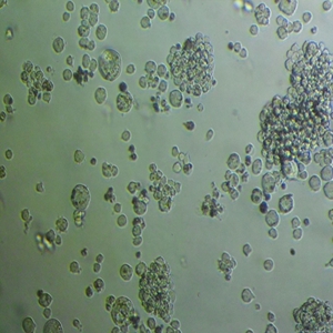 HFLS-RA人类关节炎成纤维样滑膜细胞