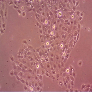 NCI-H1299人肺腺细胞