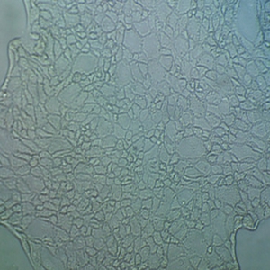 U-2 OS人骨肉细胞