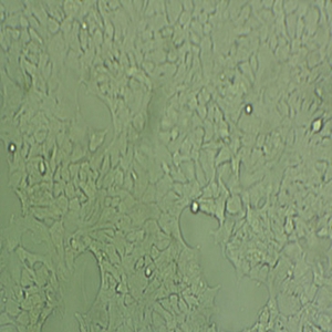 D1.1  Cells