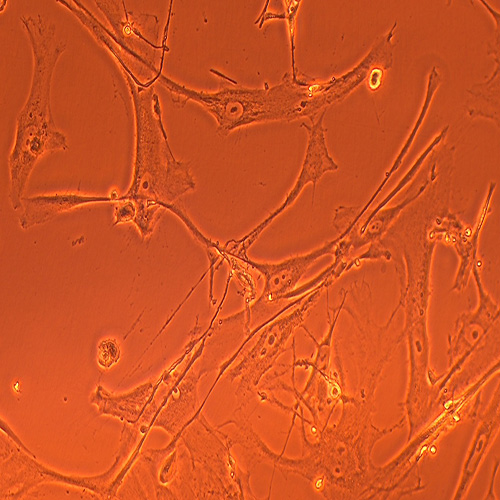 HFLS-RA类风湿关节炎成纤维样滑膜细胞