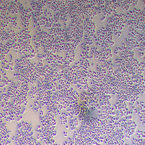 MDA-MB-468人乳腺癌细胞（STR鉴定正确）